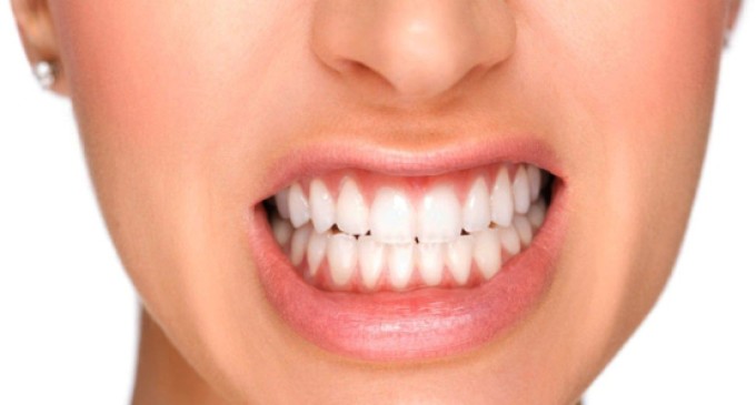 Read more about the article Como é feito o diagnóstico de Bruxismo?