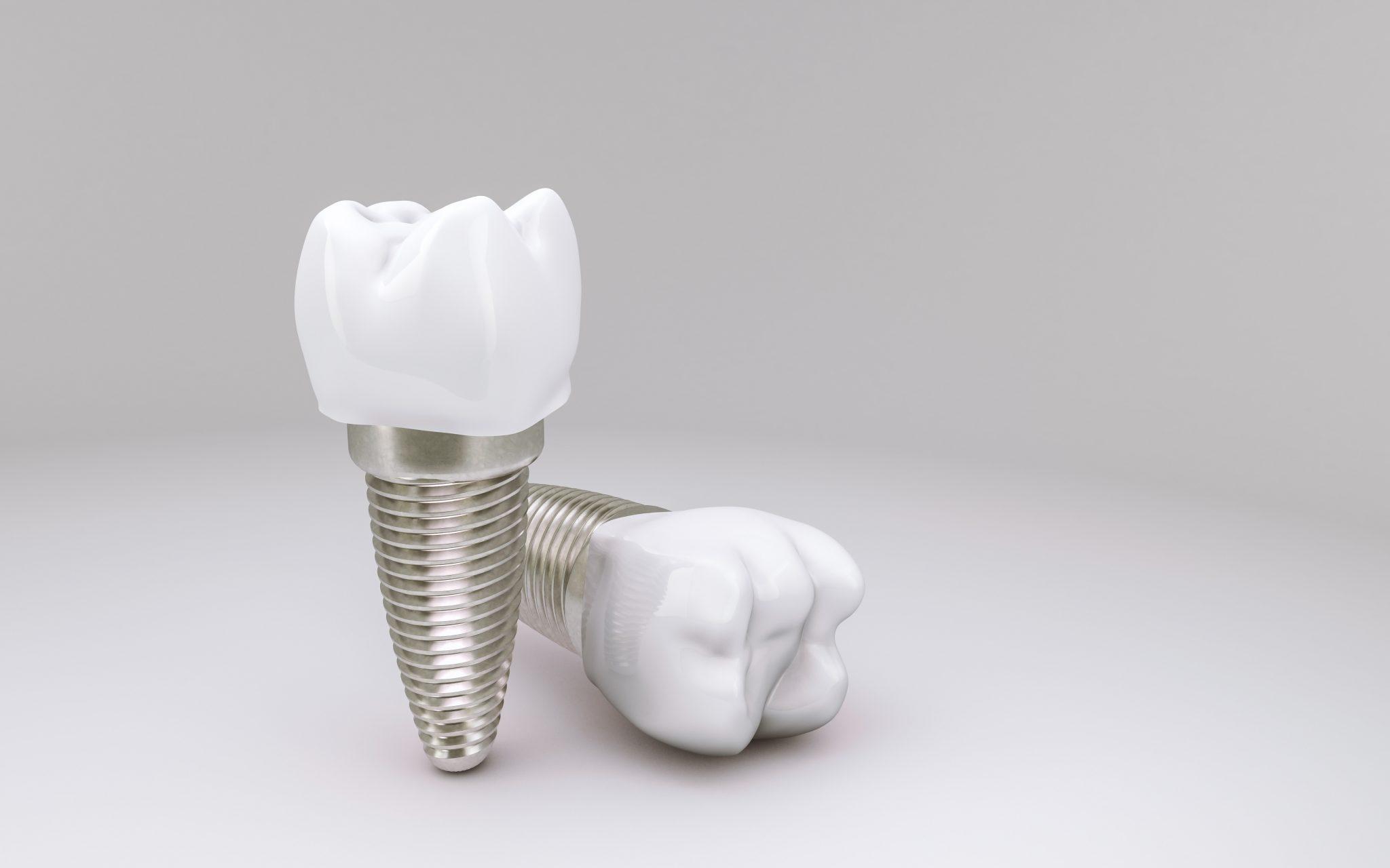 foto de um implante dentário em fundo cinza