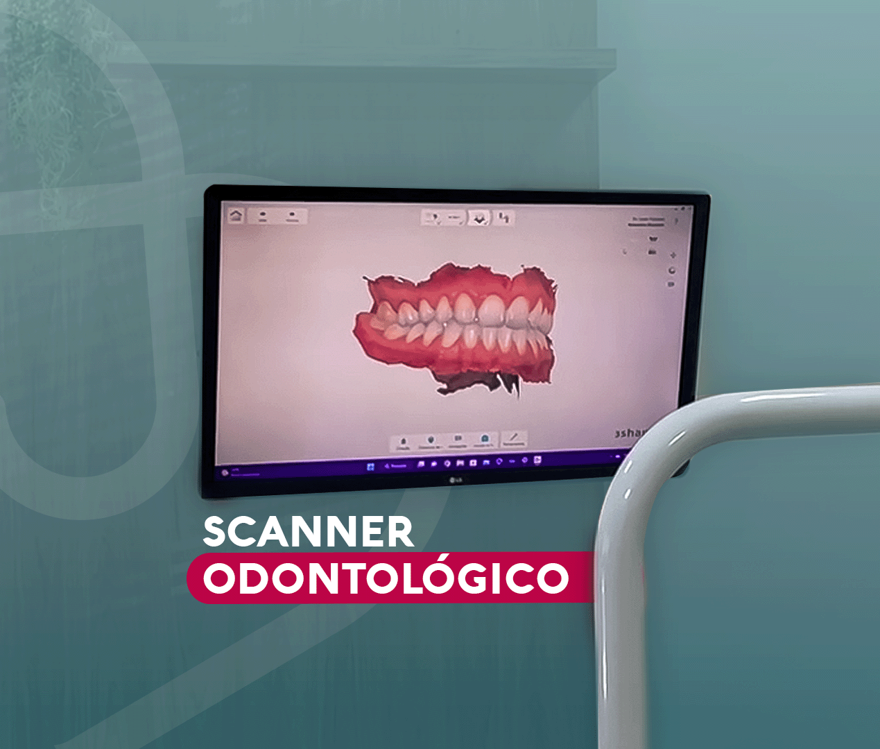 Read more about the article O que é um Scanner Odontológico e como ele pode revolucionar o tratamento dentário￼