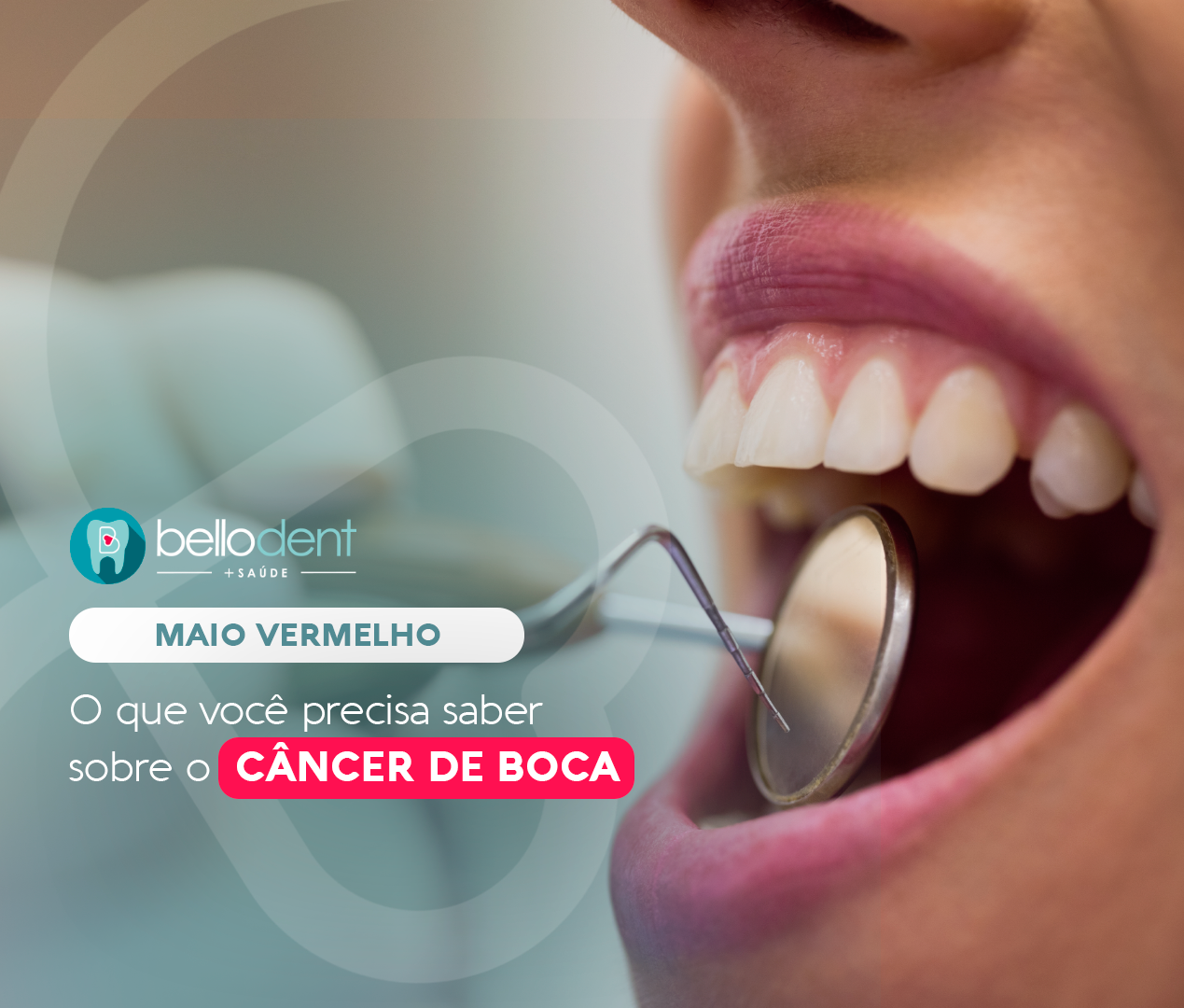 Read more about the article Maio Vermelho: O que você precisa saber sobre o câncer de boca