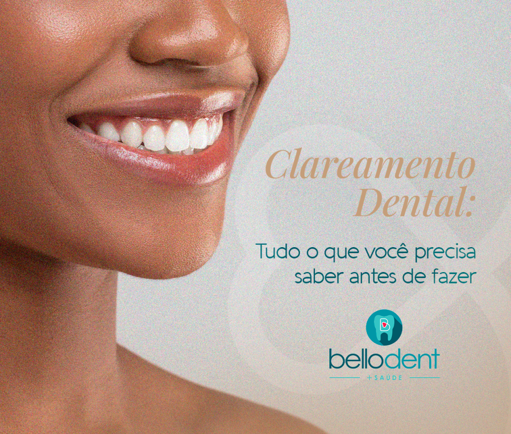  Clareamento dental: tudo o que você precisa saber antes de fazer
